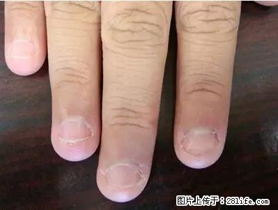 剪指甲、挖耳屎，这些日常小动作竟隐藏大危害！ - 潍坊生活资讯 - 潍坊28生活网 wf.28life.net